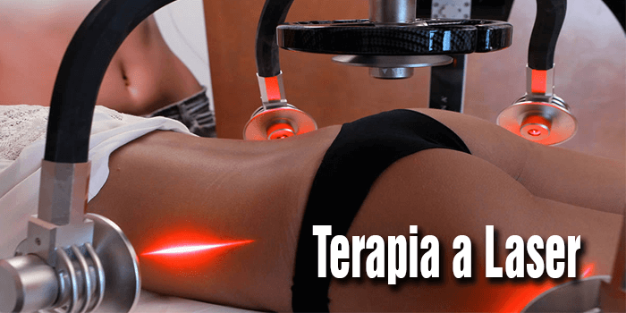 7Terapia-a-Laser-para-estrias